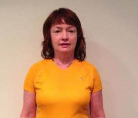 Managing Weight Issues During Menopause – Kathleen’s Story